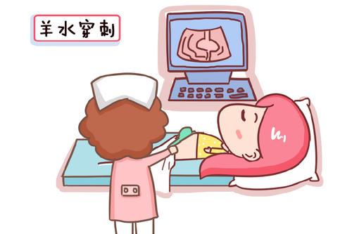 羊水穿刺有风险吗