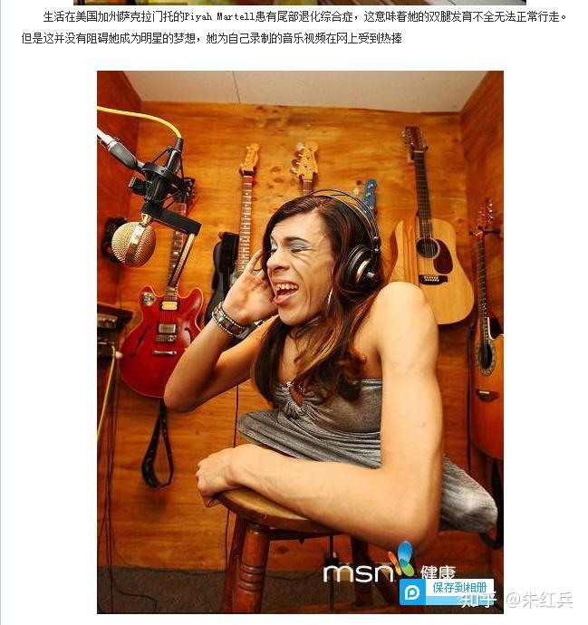 什么原因会导致尾部退化综合征
