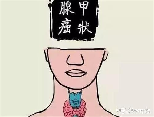 女同志突然长出喉结,武汉甲康魏医生:都是甲状腺癌在作怪!