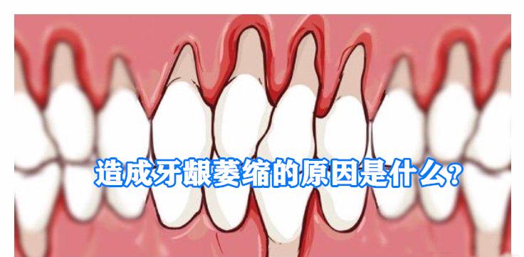 造成牙龈萎缩的原因是什么?