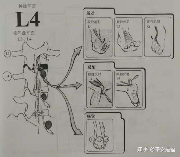 图2-28ab l5/s1椎间盘突出的脊髓造影