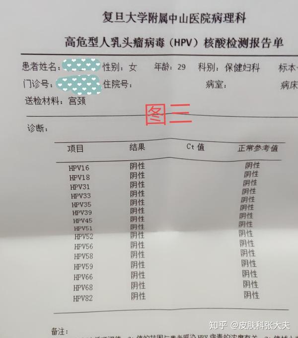 连续涂药十六天,十六天后,进行hpv检测,检测报告显示hpv全部转阴,转阴