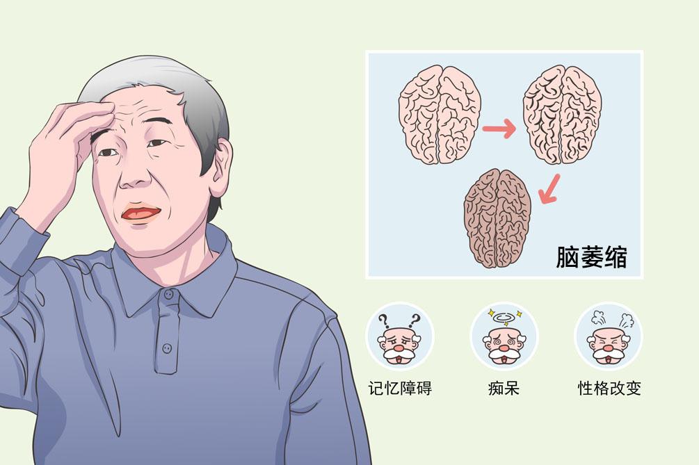 小脑萎缩患者应注意以下几个方面 1.