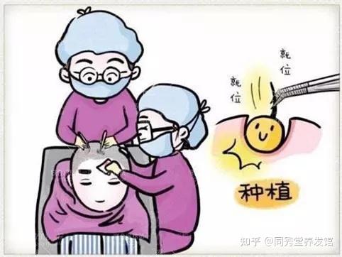 同秀堂植发养护中心:植发手术流程你知道吗?