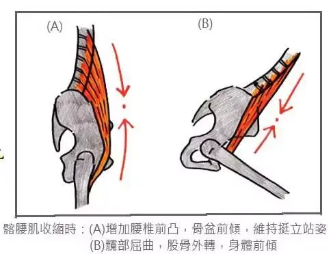 以及怎么锻炼髂腰肌?