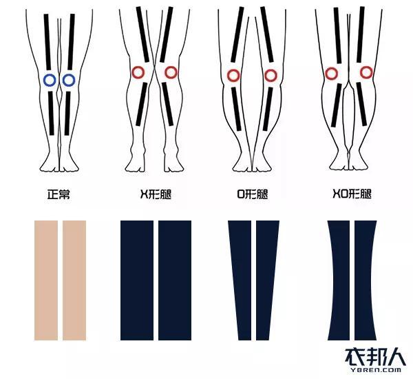 人的腿型大致可以分为以下四类:正常腿型,x型腿,o型腿,xo型腿.