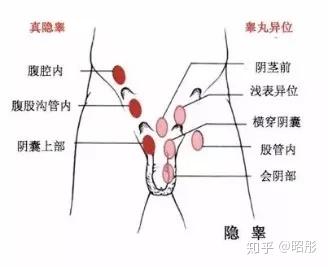 男人之本:蛋蛋的秘密