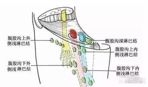 腹股沟淋巴生理结构图 位于大腿与腹腔链接处,而在我们人体内大腿腹