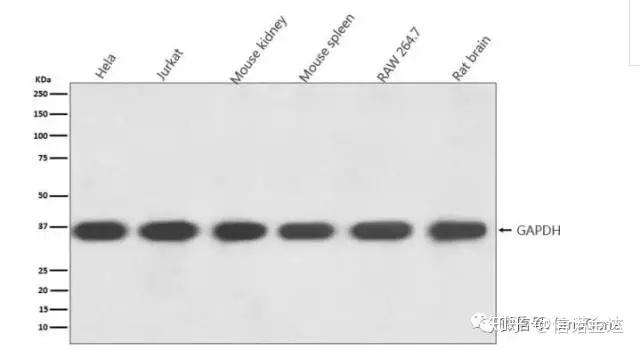 Western Blot 中如何选择内参抗体 知乎