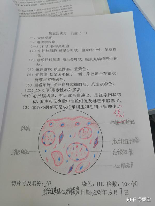 纤维素性心外膜炎红蓝铅