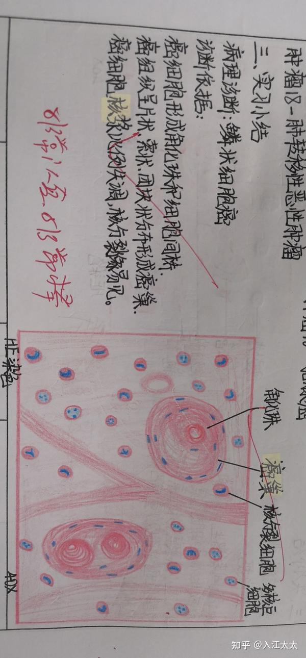 病理学实验的切片红蓝绘图呀,伸手党回馈社会 有病理诊断和诊断依据