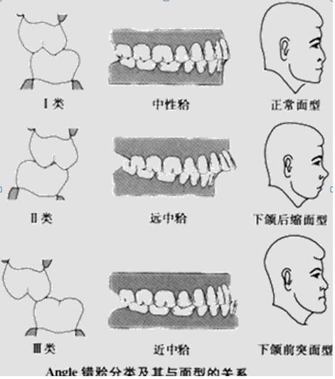 牙齿不好对人面相的影响有多大济南口腔