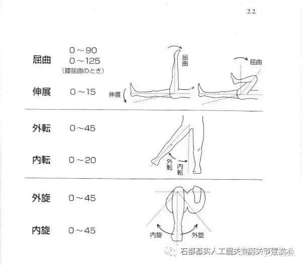 微创髋关节置换手术术后可以恢复到何种程度