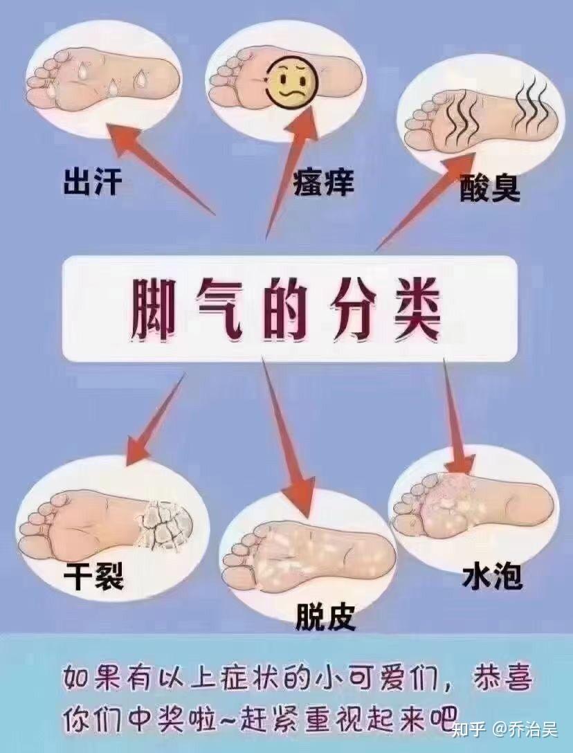 脚气怎么治才能除根?急 知乎