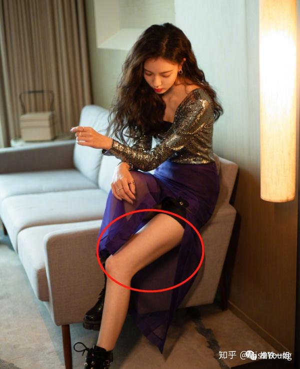 在翻看一张硬照的时候,一姐注意到宋妍霏的大腿有一道凹痕.