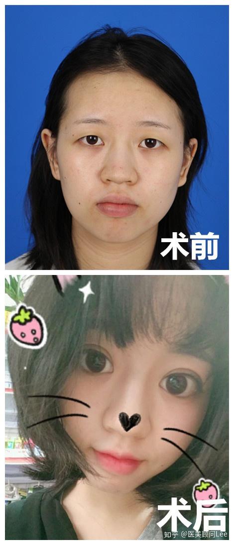 太阳穴凹陷,颧骨凸出的脸型会给人一种不太柔和甚至是尖酸刻薄的感觉