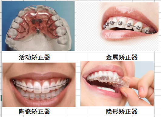 检查口腔问题,最后医生给出方案就可以大概了解牙齿的矫正难