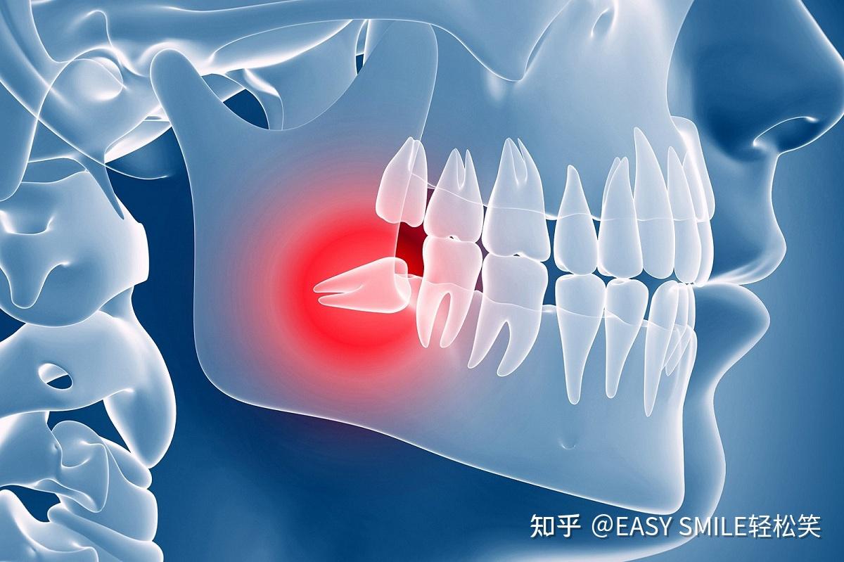 如何判断是否长了智齿