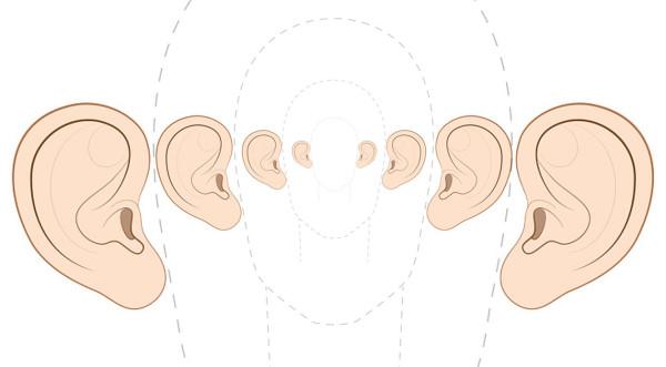 耳再造那些事儿二十一再造耳朵的相似度