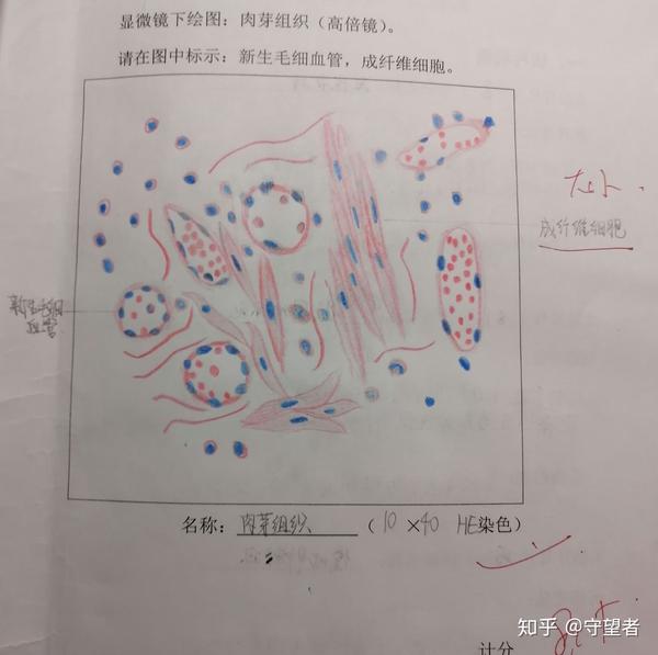 刚画的时候不知道从何下手  (我画的并不好…) 成纤维细胞画的太大了