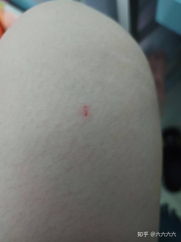 请问像不像是小狗抓伤的