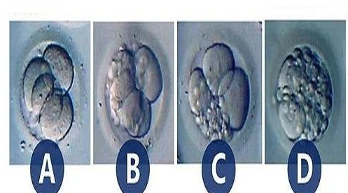 优质胚胎如何界定?