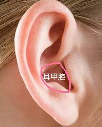 但是,很多小耳患者及家属都会问:为什么再造的耳窝(耳甲腔)有的深有的