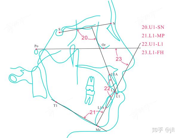 头影测量——华西分析法