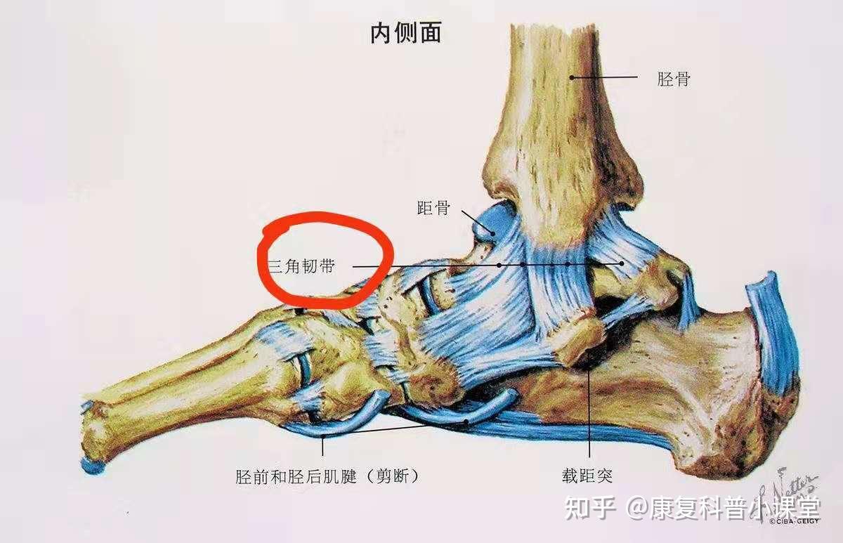 踝部韧带二级损伤怎么办