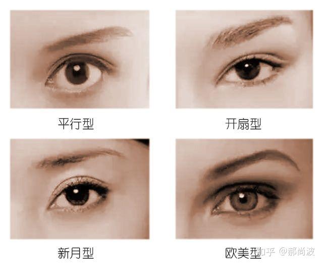 双眼皮都分为哪几种形态