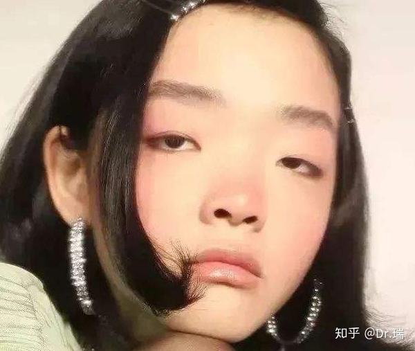 眼距宽是种什么体验