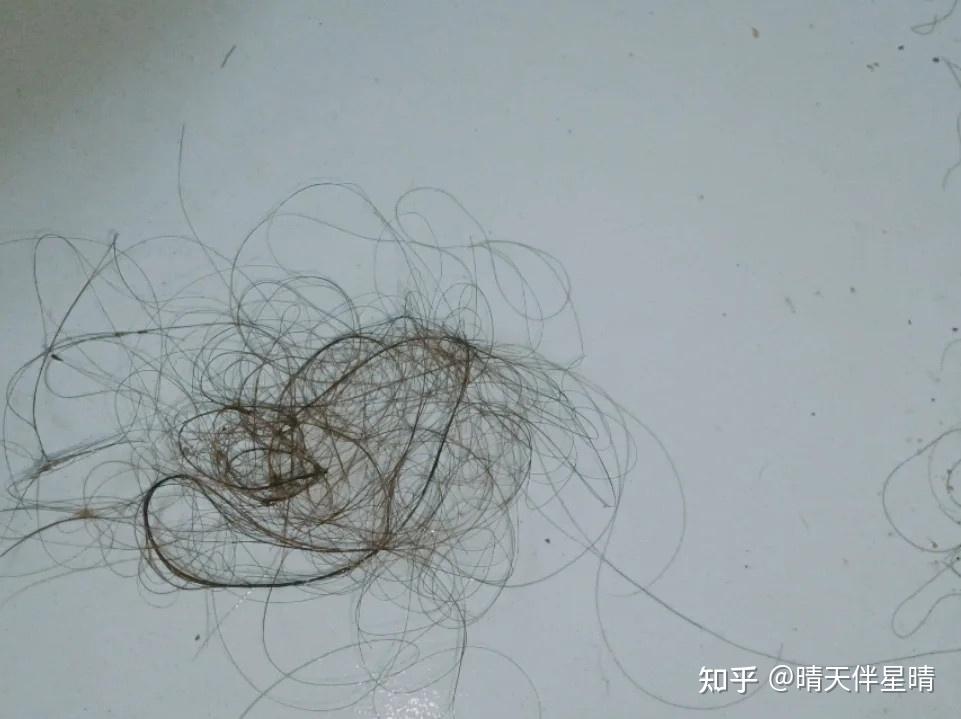 女生脱发该如何面对如何避免掉发脱发或者减少脱发