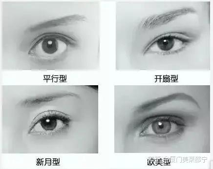 平行双眼皮适合五官立体,且脸型是瓜子脸或者鹅蛋脸,同时眉眼的间距略