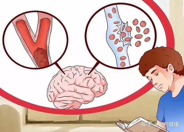 秋季是脑卒中"高危期"?做对这7件事,让你远离中风