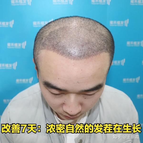 朋友圈也能经常看到他的自拍照了.