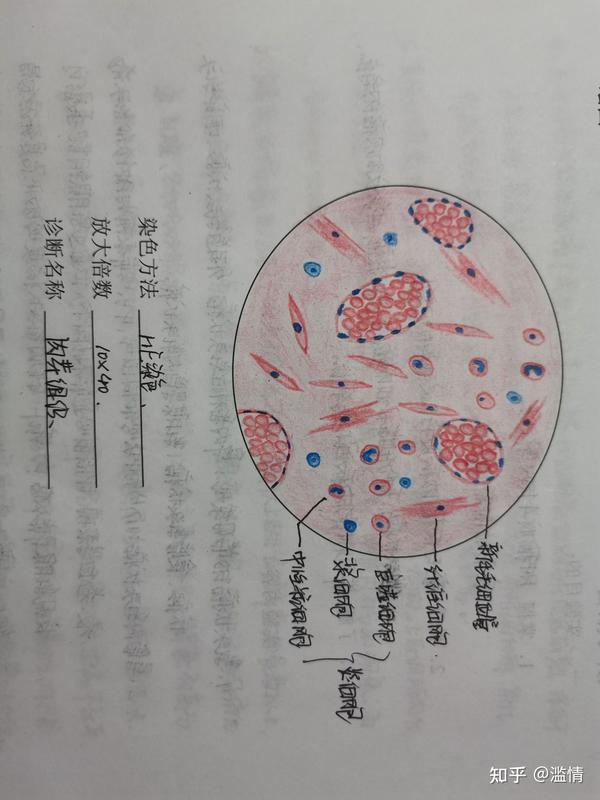 病理学组织切片红蓝铅手绘图