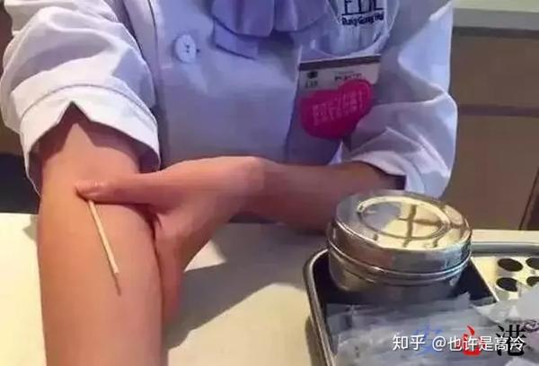 最全止血攻略:抽血后正确的按压手法