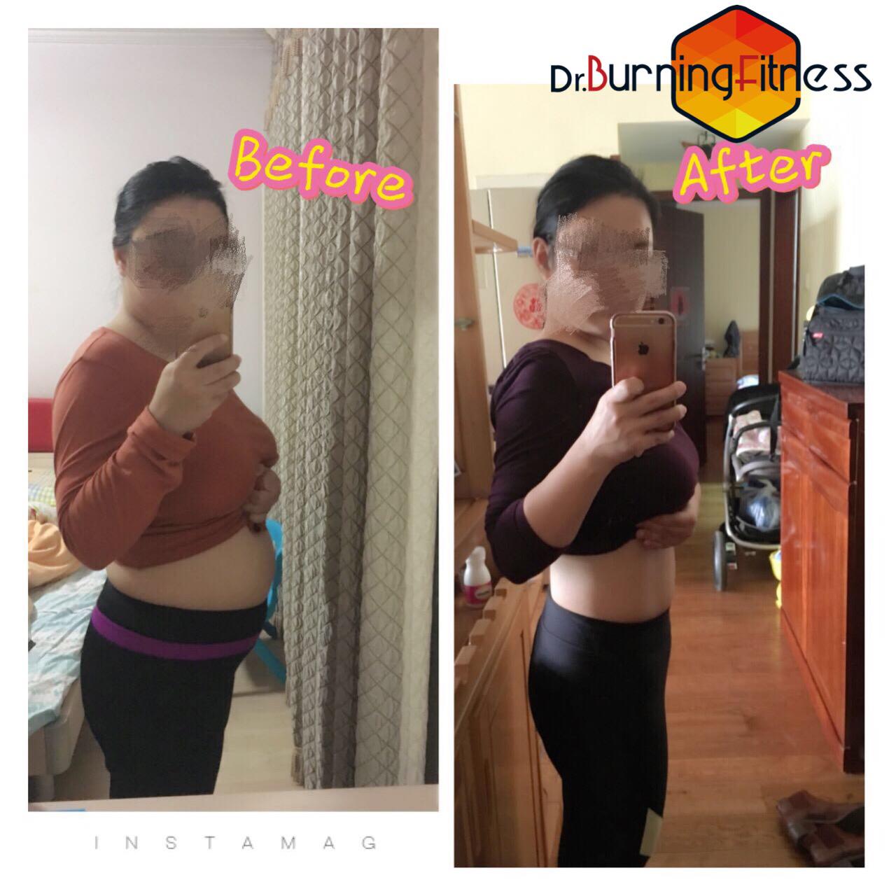 【超全脱水干货】腹直肌分离修复——产后大妈变辣妈!