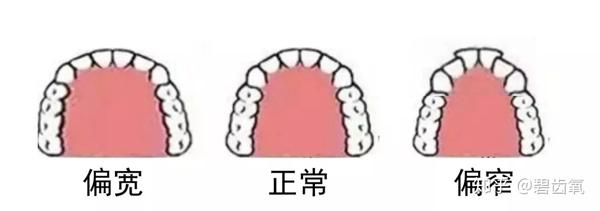 别的女孩都在做笑线练习了你还在抠脚