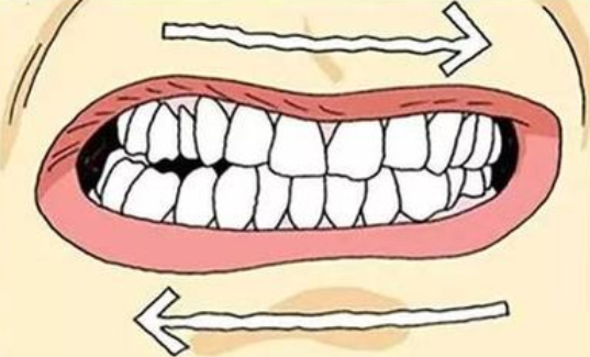 牙齿咬合不协调,不但影响咀嚼,更是导致磨牙的"凶手?