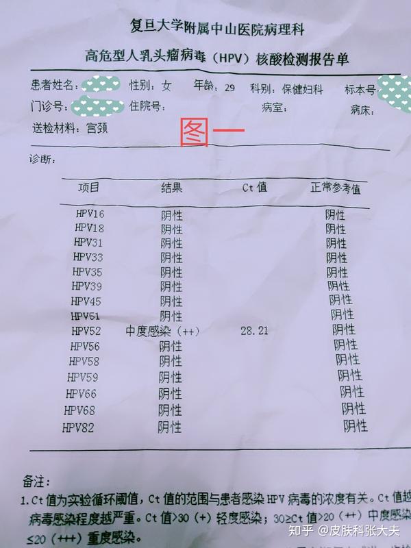 连续涂药十六天,十六天后,进行hpv检测,检测报告显示hpv全部转阴,转阴