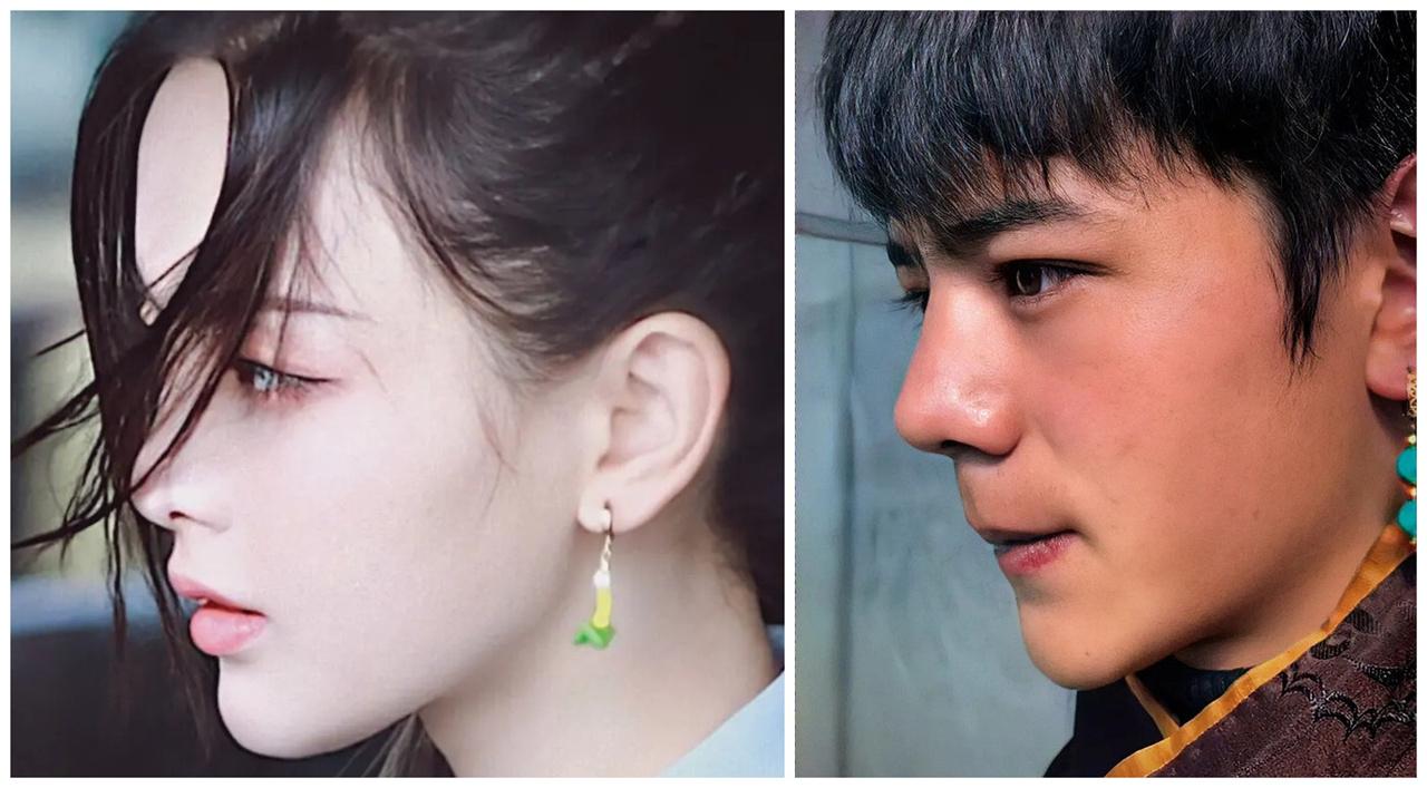 "侧颜杀"你有吗?范芳医生谈侧颜美