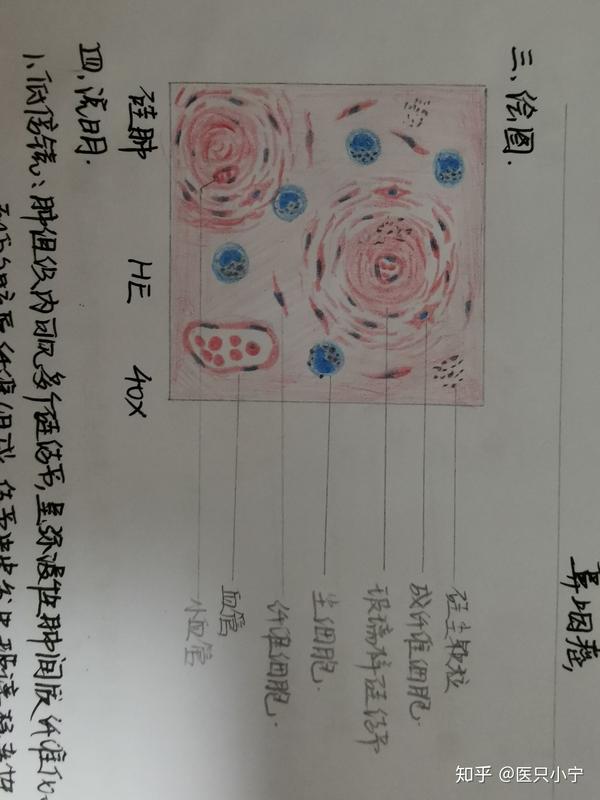 大二临床病理学红蓝铅笔图