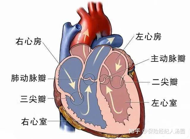 心脏瓣膜疾病示意图