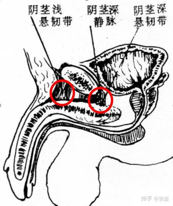 阴茎增大锻炼法(二)手术篇