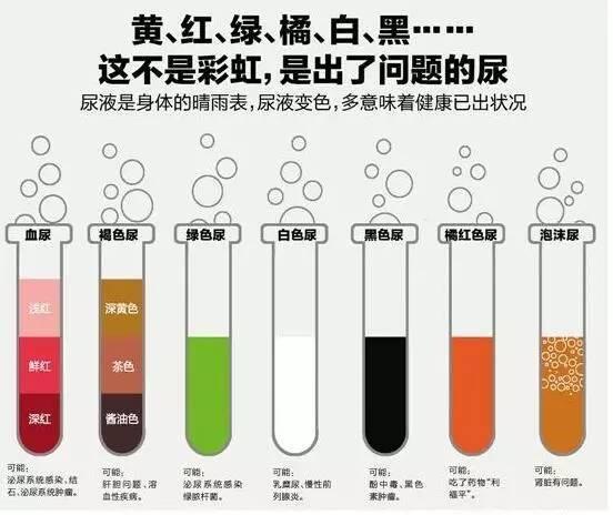 尿液与肾脏是一种什么样的关系呢