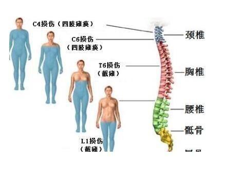 脊髓损伤|临床表现有哪些