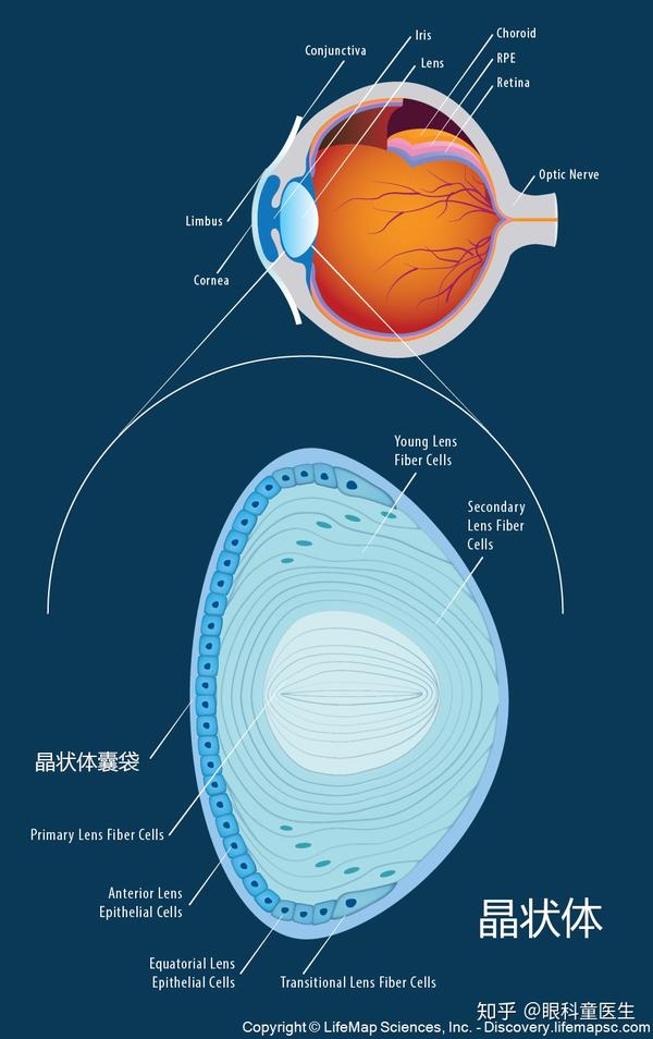下图中晶状体囊袋内蓝色的细胞为晶状体上皮细胞,具有增殖活性,白色的