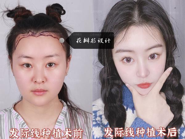 不同形状的发际线适合什么样的脸型呢?