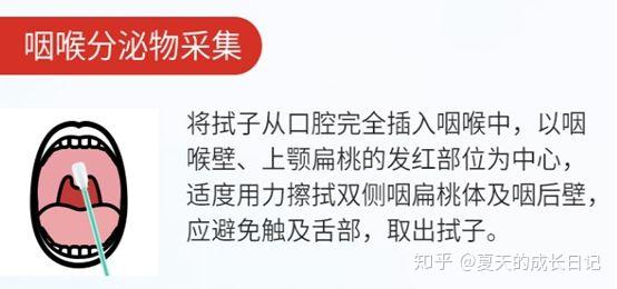 宝宝扁桃体发炎,该不该切除?